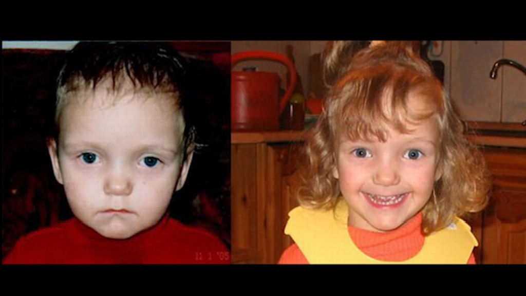 Діти до та після усиновлення: зворушливі фото